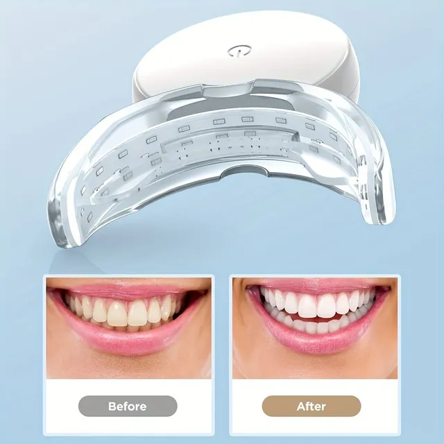 Białe zęby od Fairywill: Zestaw do wybielania zębów