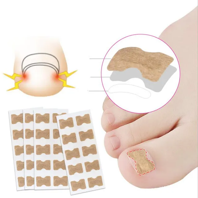 Adhesive-free anti-growing nail patches (10pcs)