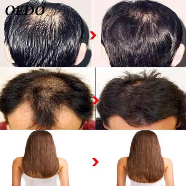 Vlasové sérum proti vypadávání vlasů s ženšenem