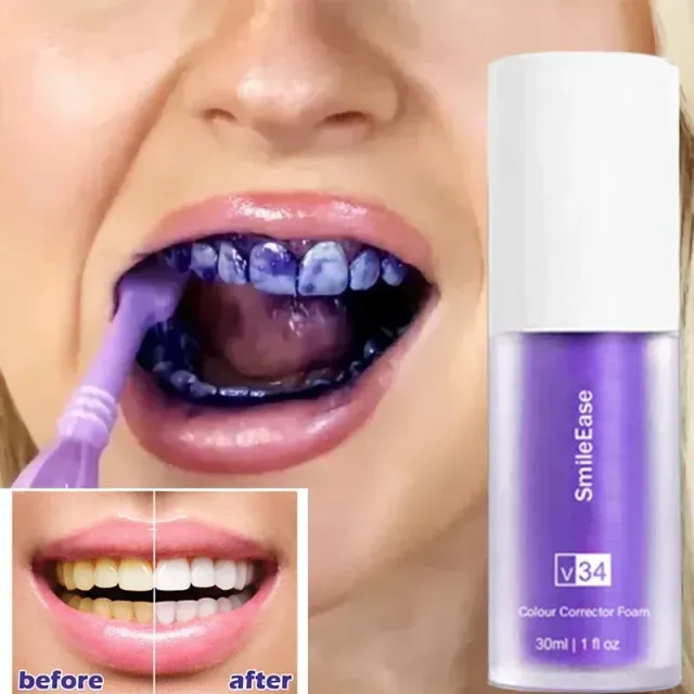 Teeth whitening corrector V34 30 ml