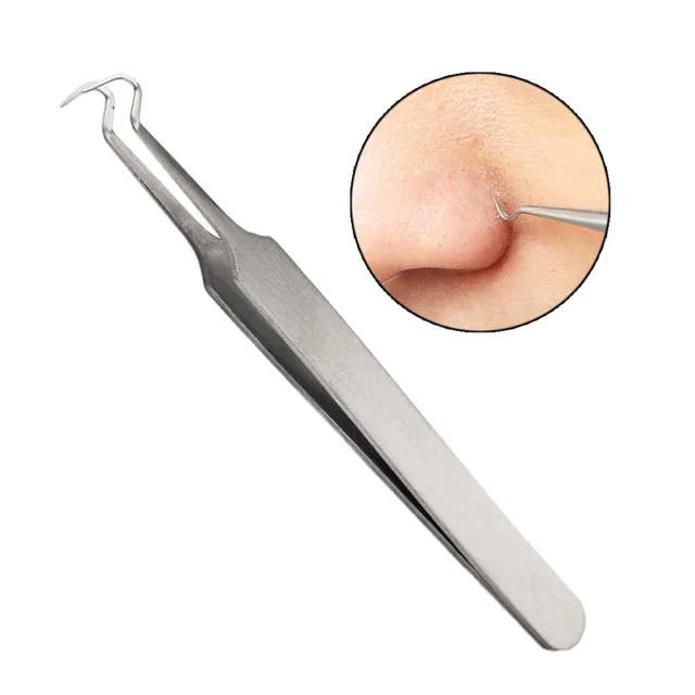 Tweezers for acne removal - 3pcs
