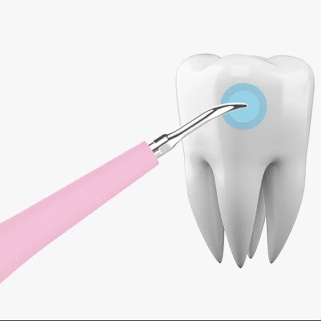 Dispozitiv electronic pentru îndepărtarea tartrului dentar