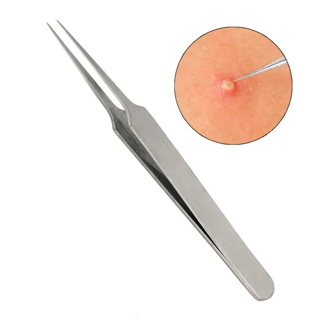 Tweezers for acne removal - 3pcs