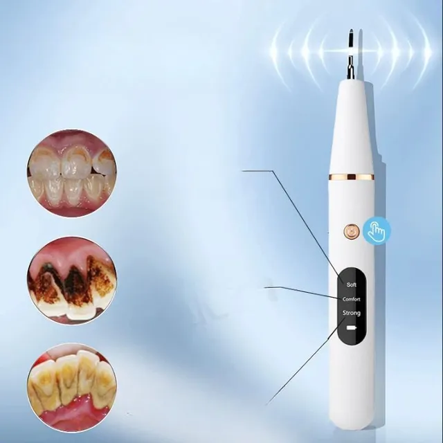 Dispozitiv ultrasunete pentru îndepărtarea tartrului dentar cu oglindă