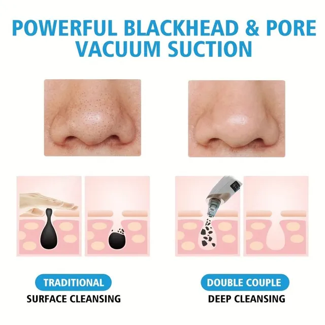 Vacuum pore cleaner - Removing black dots, 5 degrees of force, 5 extensions, USB recharge (For adults)