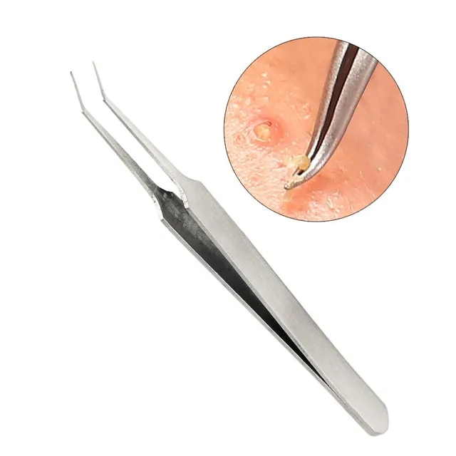 Tweezers for acne removal - 3pcs