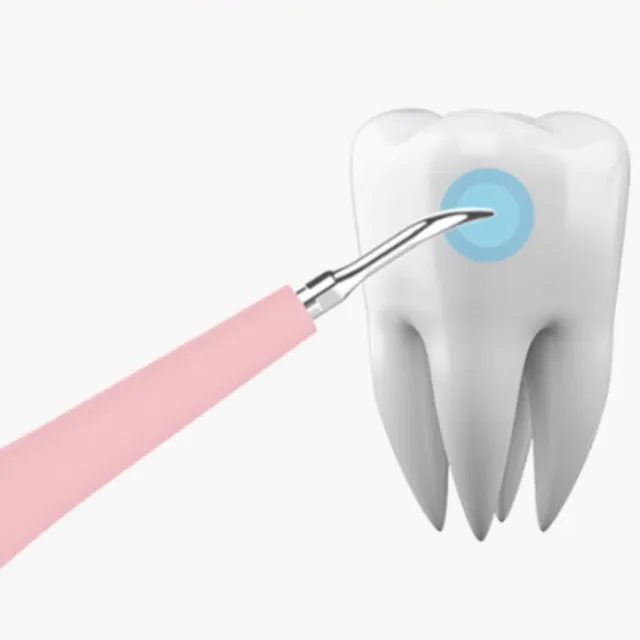 Curățător ultrasonic de dinți pentru acasă