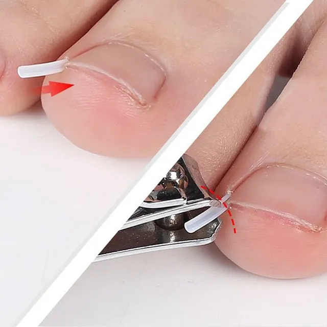 Handy set of anti-growing silicone nail covers - 10 pcs Nevio