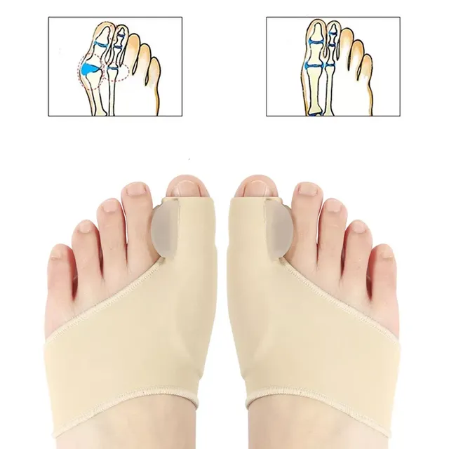 Korrektor für Hallux Valgus mit Zehentrenner für orthopädische Einlagen