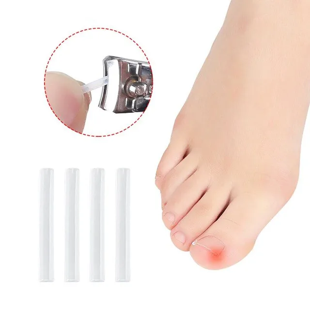 Poręczny zestaw silikonowych nakładek na paznokcie zapobiegających wrastaniu - 10 szt Nevio