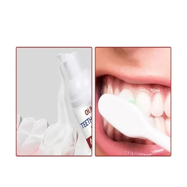 Active cleansing foam against tooth decay, removal of plaque and odor from the mouth