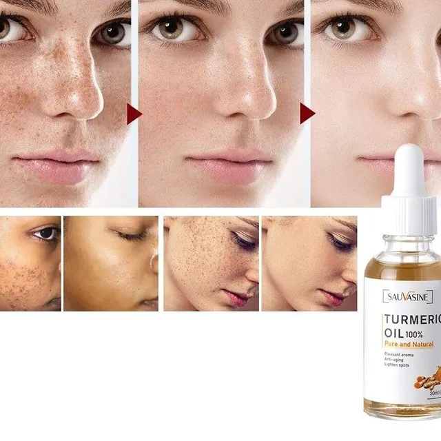 Skin oil against pigment spots 30 ml