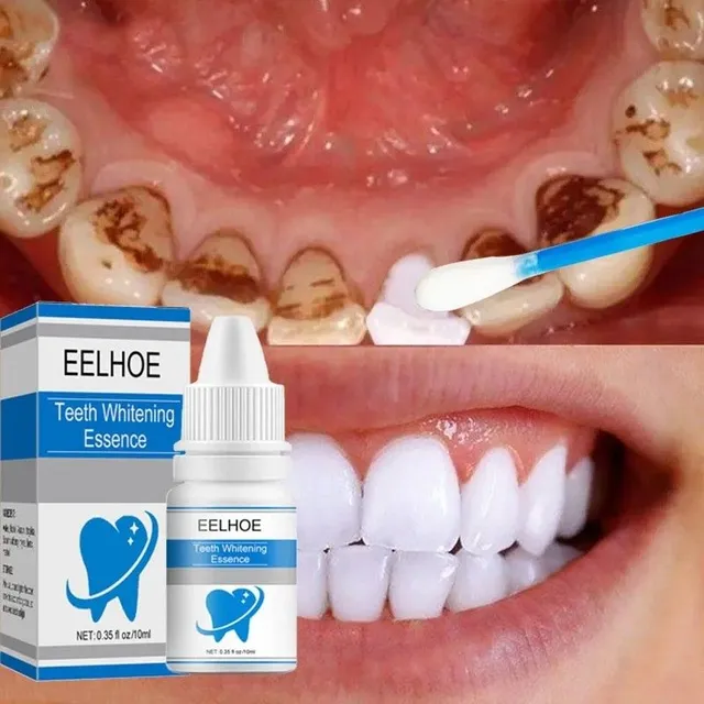 Teeth whitening preparation 10 ml