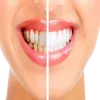 Bělicí přípravky na zuby