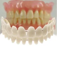 Proteză dentară detașabilă - fațete temporare - 1 pereche