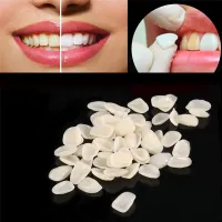 Dental ultra-thin resin veneers for temporary care 70pcs Gilbert